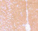 GABBR2 Antibody in Immunohistochemistry (Paraffin) (IHC (P))