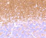 GABBR2 Antibody in Immunohistochemistry (Paraffin) (IHC (P))