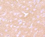 GABBR2 Antibody in Immunohistochemistry (Paraffin) (IHC (P))