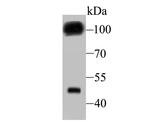 GABBR2 Antibody in Western Blot (WB)