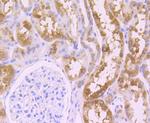 WNT2B Antibody in Immunohistochemistry (Paraffin) (IHC (P))