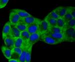 VAMP1 Antibody in Immunocytochemistry (ICC/IF)