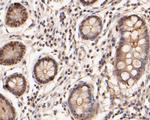 ICAD Antibody in Immunohistochemistry (Paraffin) (IHC (P))