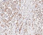 UBE2B Antibody in Immunohistochemistry (Paraffin) (IHC (P))