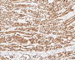 UBE2B Antibody in Immunohistochemistry (Paraffin) (IHC (P))