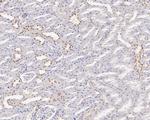 GTF2I Antibody in Immunohistochemistry (Paraffin) (IHC (P))