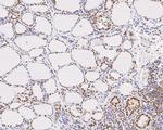 GTF2I Antibody in Immunohistochemistry (Paraffin) (IHC (P))