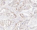 GTF2I Antibody in Immunohistochemistry (Paraffin) (IHC (P))