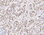 GTF2I Antibody in Immunohistochemistry (Paraffin) (IHC (P))