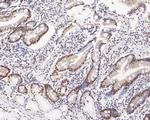 GTF2I Antibody in Immunohistochemistry (Paraffin) (IHC (P))