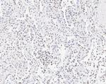 NAT10 Antibody in Immunohistochemistry (Paraffin) (IHC (P))