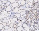 GATAD2A Antibody in Immunohistochemistry (Paraffin) (IHC (P))