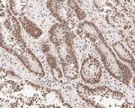 GATAD2A Antibody in Immunohistochemistry (Paraffin) (IHC (P))