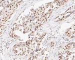 GATAD2A Antibody in Immunohistochemistry (Paraffin) (IHC (P))