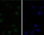 CtBP2 Antibody in Immunocytochemistry (ICC/IF)