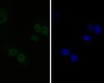 CtBP2 Antibody in Immunocytochemistry (ICC/IF)