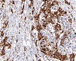 CtBP2 Antibody in Immunohistochemistry (Paraffin) (IHC (P))