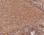 MRPL28 Antibody in Immunohistochemistry (Paraffin) (IHC (P))