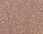 MRPL28 Antibody in Immunohistochemistry (Paraffin) (IHC (P))