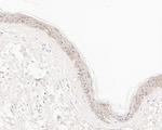 ABH1 Antibody in Immunohistochemistry (Paraffin) (IHC (P))