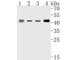 ABH1 Antibody in Western Blot (WB)