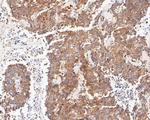 EIF2A Antibody in Immunohistochemistry (Paraffin) (IHC (P))