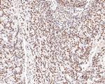 MBD2 Antibody in Immunohistochemistry (Paraffin) (IHC (P))