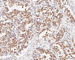 MBD2 Antibody in Immunohistochemistry (Paraffin) (IHC (P))