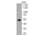 MBD2 Antibody in Western Blot (WB)