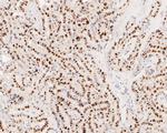 EGR1 Antibody in Immunohistochemistry (Paraffin) (IHC (P))