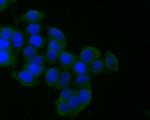 CD21 Antibody in Immunocytochemistry (ICC/IF)