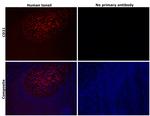 CD21 Antibody in Immunohistochemistry (Paraffin) (IHC (P))