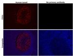 CD21 Antibody in Immunohistochemistry (Paraffin) (IHC (P))