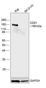 CD21 Antibody in Western Blot (WB)