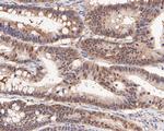 PCBP1 Antibody in Immunohistochemistry (Paraffin) (IHC (P))