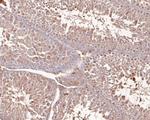 NSUN4 Antibody in Immunohistochemistry (Paraffin) (IHC (P))