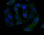 NSUN4 Antibody in Immunocytochemistry (ICC/IF)