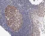 FEN1 Antibody in Immunohistochemistry (Paraffin) (IHC (P))