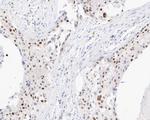 FEN1 Antibody in Immunohistochemistry (Paraffin) (IHC (P))