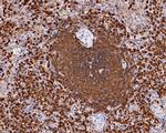 p47phox Antibody in Immunohistochemistry (Paraffin) (IHC (P))