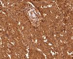 eIF6 Antibody in Immunohistochemistry (Paraffin) (IHC (P))