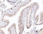 POLR2A Antibody in Immunohistochemistry (Paraffin) (IHC (P))