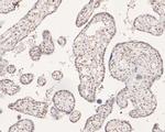 POLR2A Antibody in Immunohistochemistry (Paraffin) (IHC (P))