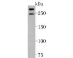 POLR2A Antibody in Western Blot (WB)