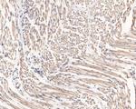 CLIC2 Antibody in Immunohistochemistry (Paraffin) (IHC (P))