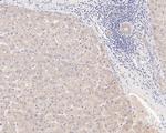 CLIC2 Antibody in Immunohistochemistry (Paraffin) (IHC (P))