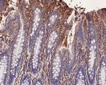 LRP6 Antibody in Immunohistochemistry (Paraffin) (IHC (P))