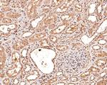 CENPB Antibody in Immunohistochemistry (Paraffin) (IHC (P))