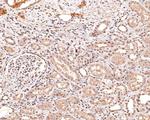 CENPB Antibody in Immunohistochemistry (Paraffin) (IHC (P))