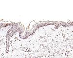 CENPB Antibody in Immunohistochemistry (Paraffin) (IHC (P))